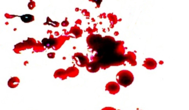 Khám Phá Những Ý Nghĩa Bí Ẩn Về Giấc Mơ Thấy Máu