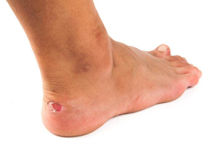 Nằm Mơ Thấy Vết Thương Đánh Con Gì? Giải Mã Giấc Mơ Thấy Vết Thương Đánh Số Mấy?