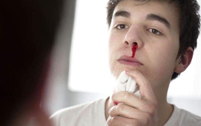 Nằm Mơ Thấy Chảy Máu Mũi Đánh Con Gì? Giải Mã Giấc Mơ Thấy Chảy Máu Mũi?