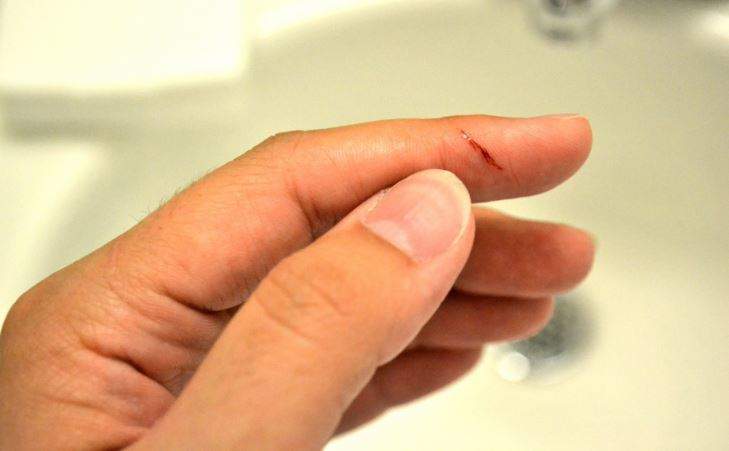 Nằm Mơ Thấy Chảy Máu Tay Đánh Con Gì? Giải Mã Giấc Mơ Thấy Chảy Máu Tay?